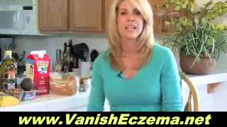 Beating Food Allergy Related Eczema With Eczema Gone [upl. by Ahsiekrats]