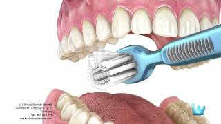 Higiene dental  Clinica identis [upl. by Oisorbma130]