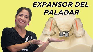 Expansor del paladar [upl. by Anirtak]