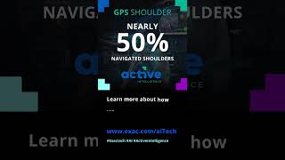 50 Navigated GPS Shoulder [upl. by Henrique]