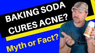 Baking Soda Mask For Acne  How To And What To Expect  CHRIS GIBSON [upl. by Mani]