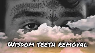 Wisdom Tooth Near Death Experience [upl. by Dorrie]