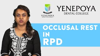 Occlusal Rest In RPD  Prosthodontics  Yenepoya Dental College [upl. by Ula542]