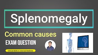 Splenomegaly Exam Question [upl. by Schwarz]