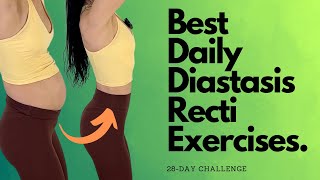 Heal amp Flatten With These Daily Diastasis Recti Exercises [upl. by Eneroc]