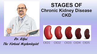 Stages of Chronic Kidney Disease CKD  The Virtual Nephrologist  Dr Rifai [upl. by Yelsnia]