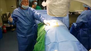 INTO LB LIVE SURGERY L4 5 [upl. by Chester]