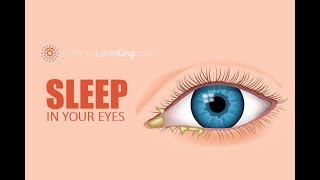 Eye Discharge Eye Boogers Rheum Sleep in Your Eyes What is it What Causes It [upl. by Fabriane]