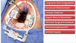 Development of a Bioengineered Decellularised Xenograft for Mitral Valve Replacement [upl. by Terrilyn]