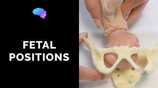 Types of Fetal Positions  OSCE Guide  UKMLA  CPSA [upl. by Mobley]