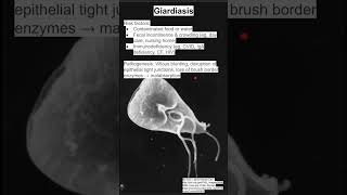 Giardiasis [upl. by Ahsatan]