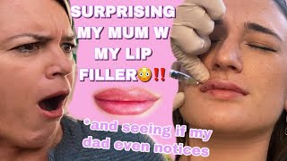 lip filler vlog mums reaction [upl. by Doran]