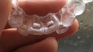 Invisalign Diary 3 Attachments and a cold [upl. by Dis623]