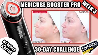 MEDICUBE BOOSTER PRO 30DAY CHALLENGE  WEEK 3  DERMA SHOT MODE ems [upl. by Tempa622]