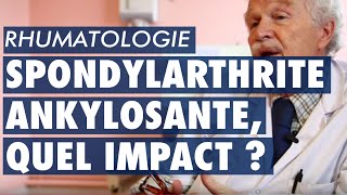 Spondylarthrite ankylosante quel impact pour les patients [upl. by Leribag]