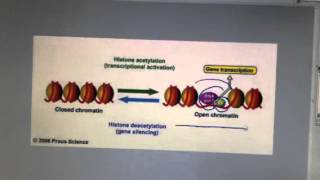 Histone acetylation [upl. by Pain]