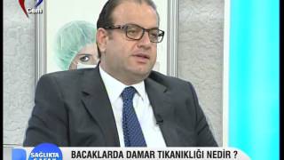 Bacaklarda Damar Tıkanıklığı ve Tedavisi Nedir [upl. by Dee]