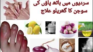 Chilblains treatmenthow to treat swollen feet finger at homeitchy finger treatmentbeauty tips [upl. by Hayotal]