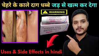 Hydroquinone tretinoin mometasone furoate cream  Pigmason cream review  Pigmason Cream [upl. by Ardnat]