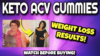 KETO ACV GUMMIES Review WATCH BEFORE BUYING  Keto ACV Gummies For Weight Loss REAL Results [upl. by Lindbom]