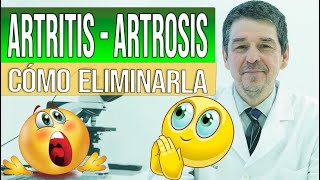 Artritis amp Artrosis  Síntomas causas amp Cómo eliminarla [upl. by Adnih]