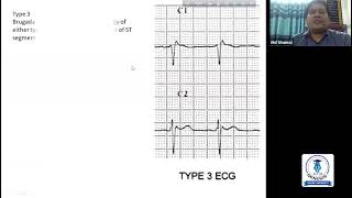 Session 11 Pericarditis Pericardial effusion Pulmonary embolism Pacemakers etc [upl. by Evreh]