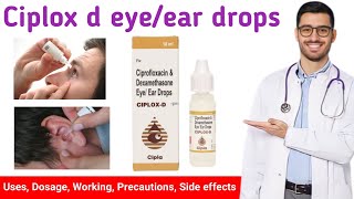 CIPROFLOXACIN EYE DROPS [upl. by Narol]