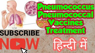 Pneumococcus Microbiology in hindi [upl. by Keheley67]