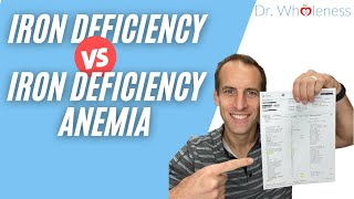 Iron deficiency without anemia vs Iron deficiency with anemia [upl. by Lihcox682]