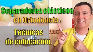 Separadores elásticos para bandas en Ortodoncia Técnicas de colocación [upl. by Applegate333]