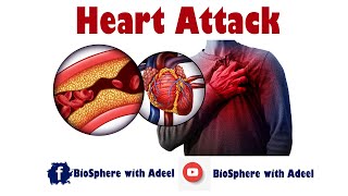 Heart Attack  Myocardial Infraction  MI [upl. by Ioab]