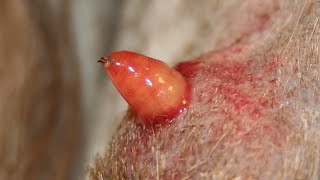 Removing Gigantic Botfly Maggot From Dogs Chest Part 12 [upl. by Azer]