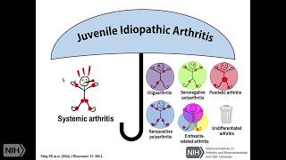 The Spectrum of Still’s Disease Genetics and Overlap with Autoinflammatory Diseases Part 2 [upl. by Stone549]