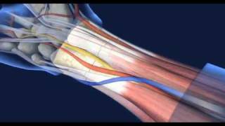 UCLA Hand Transplant Procedure [upl. by Drolyag625]