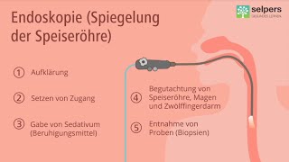 Speiseröhrenspiegelung Magenspiegelung  so läuft die Untersuchung ab Arzt informiert [upl. by Atikan]