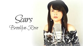 Scars  James Bay By BrooklynRose [upl. by Allmon]