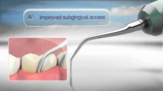 Cavitron ® FSI Slimline Einsätze  Subgingivale Behandlung [upl. by Garek]