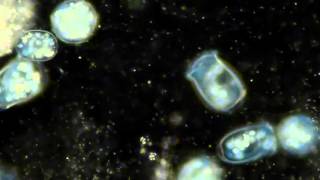 Protozoa Vorticella video [upl. by Sakovich429]