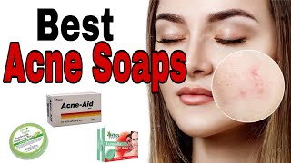 Top 13 Soaps for Acne 2020 Best Soap Bars for Oily Acne prone skin amp Blackheads Sri Lanka [upl. by Ettellocin364]