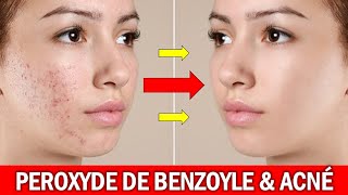 PEROXYDE DE BENZOYLE LA SOLUTION contre LACNÉ pourtant peu connue Dr Eyetemou Miguel Pharmacien [upl. by Amara500]