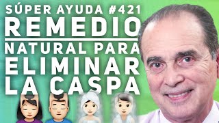 SÚPER AYUDA 421 Remedio Natural Para Eliminar La Caspa [upl. by Goff]