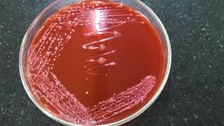 Isolation of Rhizobium on CRYEMA from Root nodules [upl. by Portuna877]