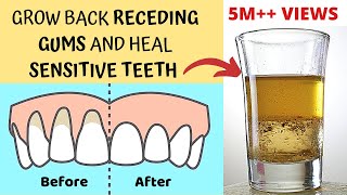 Heal Receding Gums and Grow Back  Treat Sensitive Teeth and Reverse Receding Gums  Gingivitis [upl. by Scotty574]