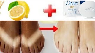 comment blanchir les pieds en 5 minutes éclaircir les pieds avec le savon dove et citron [upl. by Netnerb909]