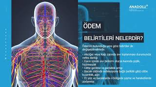 Ödem Nedir Nedenleri Neler Nasıl Ödem Atılır Ödem Atma Tarifi İle Diyetisyen Emre Çağatay [upl. by Hebel]