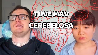 ACV y MAV Cerebelosa 🧠 [upl. by Heathcote]