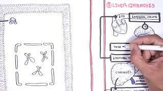 Myocarditis  causes pathophysiology investigation and treatment [upl. by Wu]