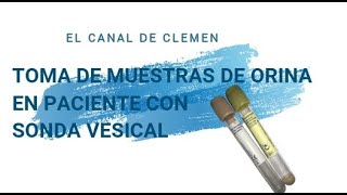 Toma de muestras de orina 🧫🧪en paciente con sonda vesical ❌🚽 [upl. by Jabe370]