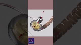 Heartware Ventricular Assist Device shorts animation [upl. by Eusoj467]