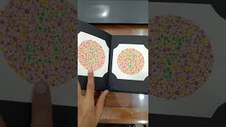 Colour Vision Test Understanding Colour Blindness Test colorblindness eyehospital eyedoctor [upl. by Graybill]